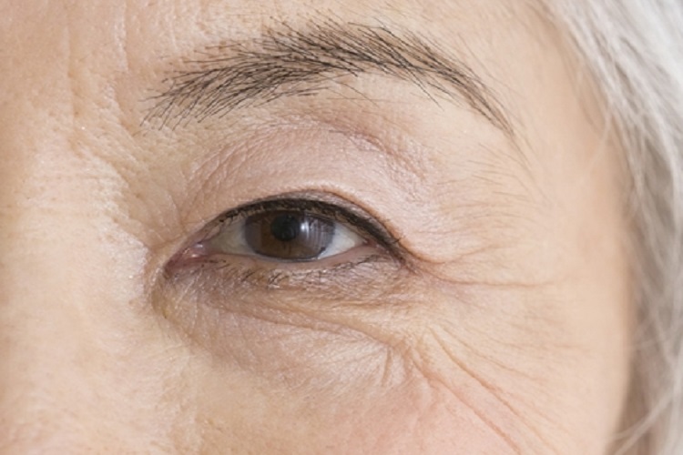 ค้นพบภูมิคุ้มกันชนิดใหม่สาเหตุของโรคเส้นประสาทตาอักเสบ
